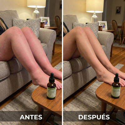 LINFATIC | Gotero Natural de Drenaje Linfático