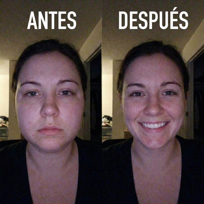 LINFATIC | Gotero Natural de Drenaje Linfático