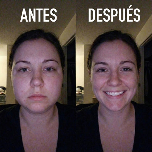 LINFATIC | Gotero Natural de Drenaje Linfático